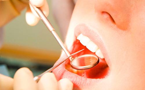 Лечение при зъболекар